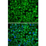 Immunofluorescence - Anti-SAT2 Antibody (A7211) - Antibodies.com