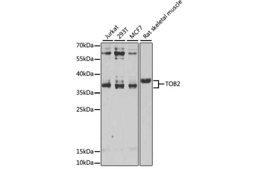 Western Blot - Anti-TOB2 Antibody (A12094) - Antibodies.com