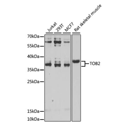 Western Blot - Anti-TOB2 Antibody (A12094) - Antibodies.com