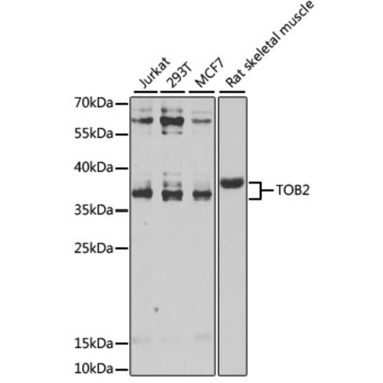 Western Blot - Anti-TOB2 Antibody (A12094) - Antibodies.com