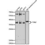 Western Blot - Anti-TOB2 Antibody (A12094) - Antibodies.com