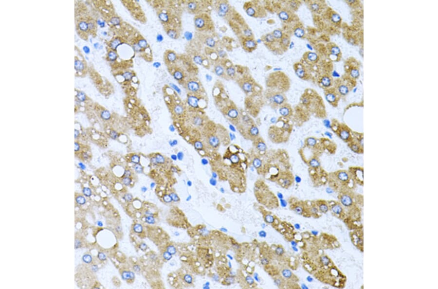 Immunohistochemistry - Anti-TOB2 Antibody (A12094) - Antibodies.com