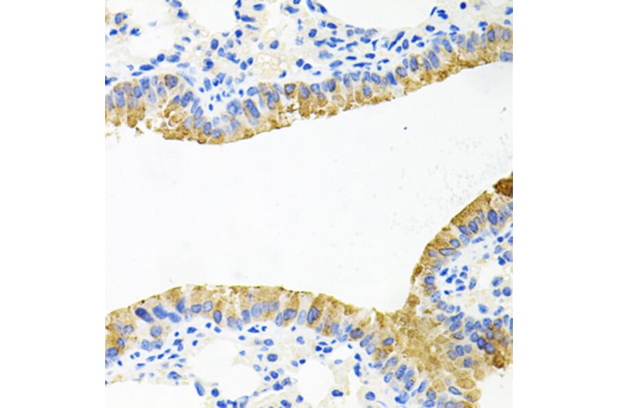 Immunohistochemistry - Anti-TOB2 Antibody (A12094) - Antibodies.com