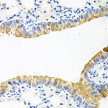 Immunohistochemistry - Anti-TOB2 Antibody (A12094) - Antibodies.com