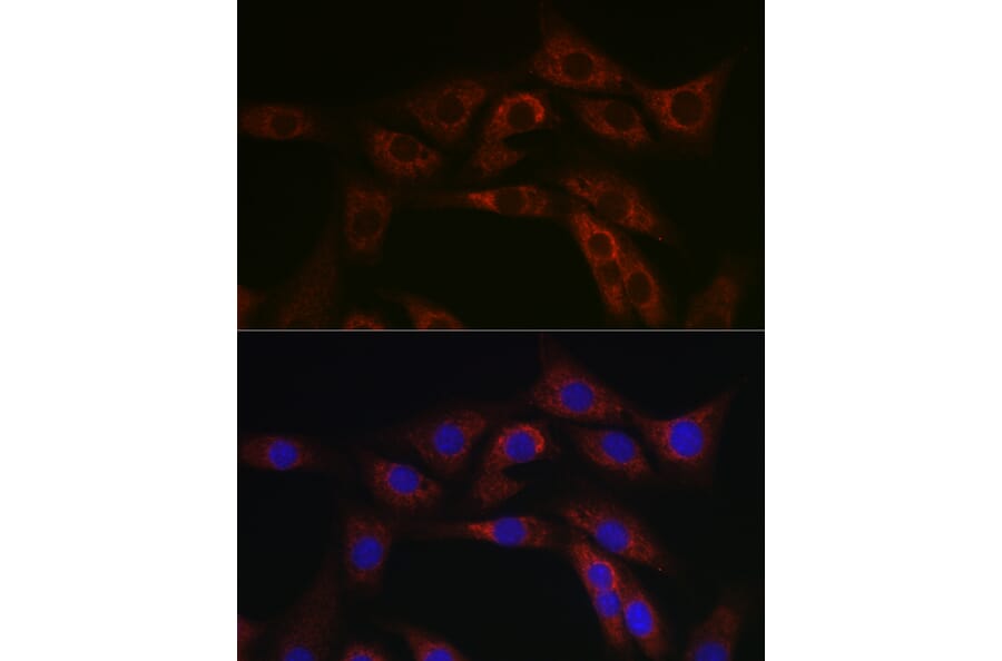 Immunofluorescence - Anti-ABCA1 Antibody (A12095) - Antibodies.com