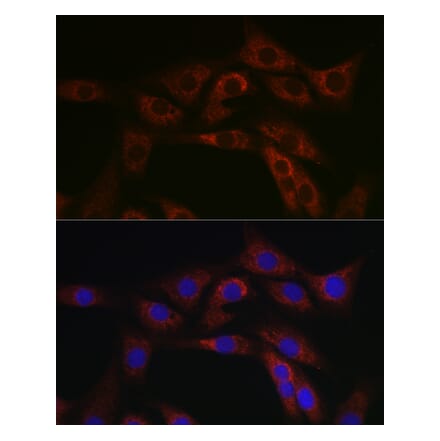 Immunofluorescence - Anti-ABCA1 Antibody (A12095) - Antibodies.com