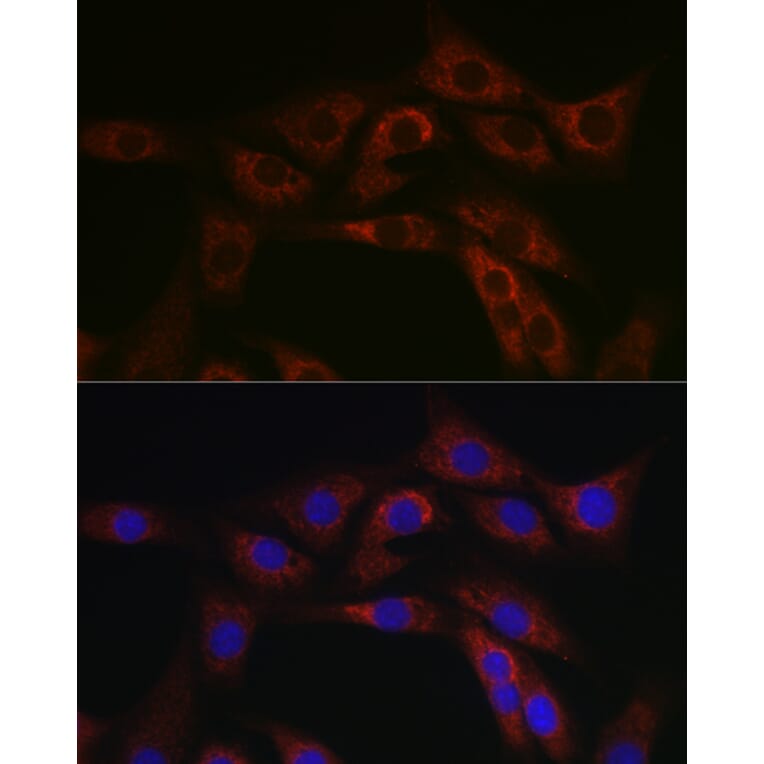 Immunofluorescence - Anti-ABCA1 Antibody (A12095) - Antibodies.com