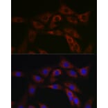 Immunofluorescence - Anti-ABCA1 Antibody (A12095) - Antibodies.com