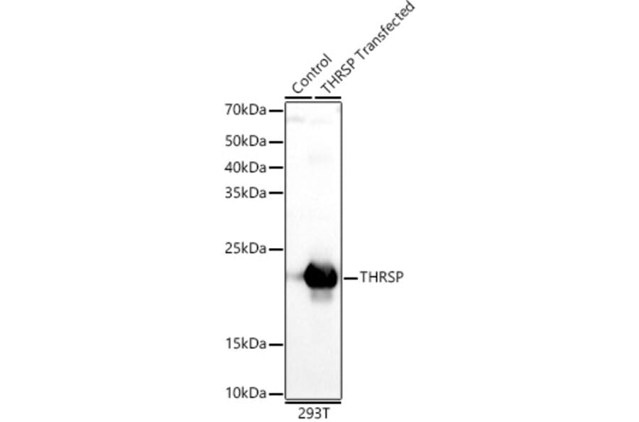 Western Blot - Anti-THRSP Antibody (A12096) - Antibodies.com