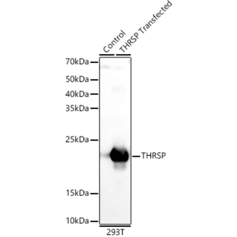 Western Blot - Anti-THRSP Antibody (A12096) - Antibodies.com