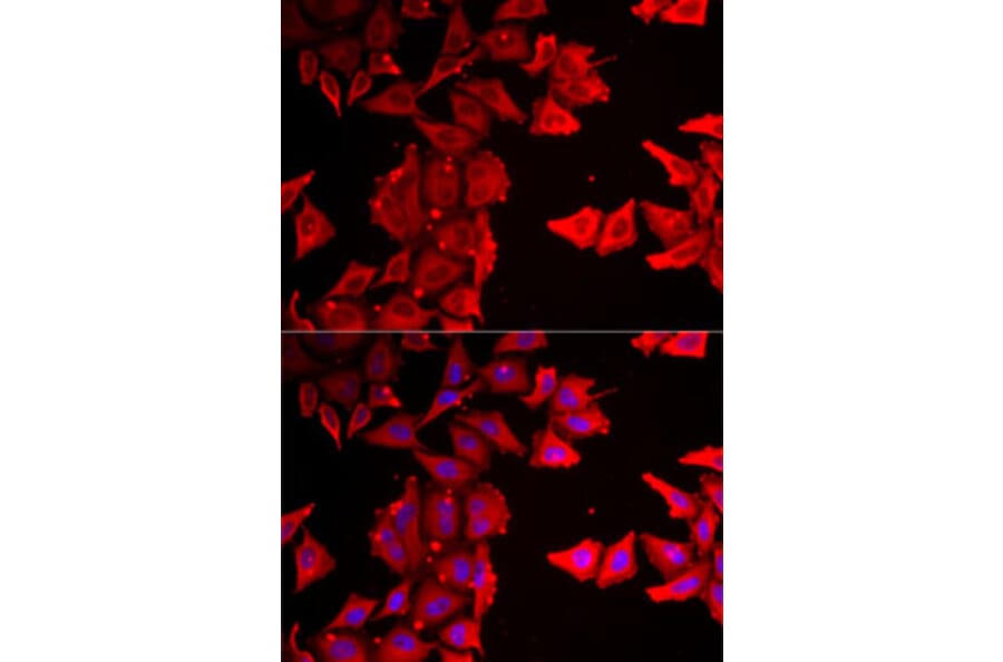 Immunofluorescence - Anti-THRSP Antibody (A12096) - Antibodies.com