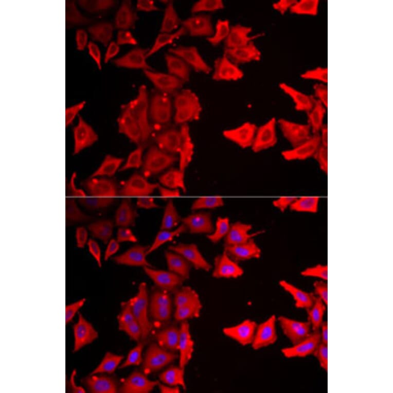 Immunofluorescence - Anti-THRSP Antibody (A12096) - Antibodies.com