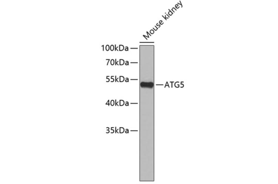 Western Blot - Anti-ATG5 Antibody (A7252) - Antibodies.com