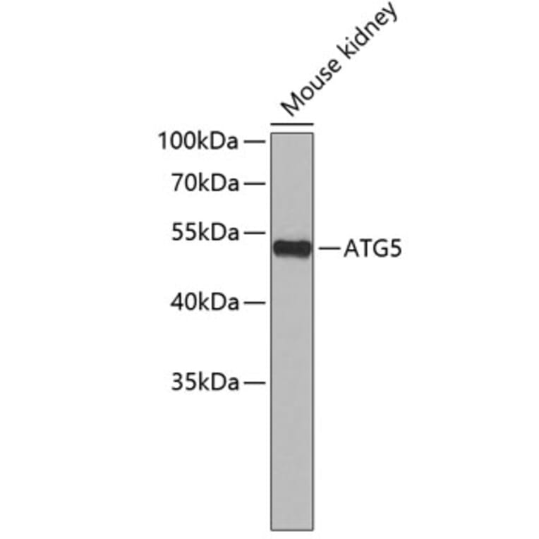Western Blot - Anti-ATG5 Antibody (A7252) - Antibodies.com