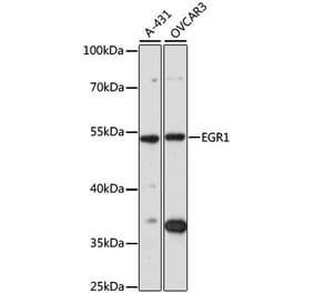 Western Blot - Anti-EGR1 Antibody (A7266) - Antibodies.com