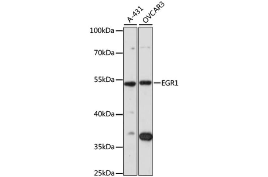 Western Blot - Anti-EGR1 Antibody (A7266) - Antibodies.com