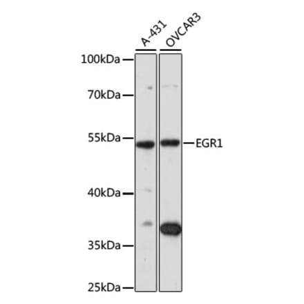 Western Blot - Anti-EGR1 Antibody (A7266) - Antibodies.com