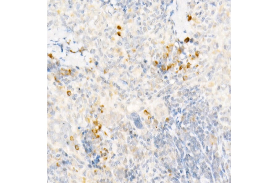 Immunohistochemistry - Anti-MCP1 Antibody (A12099) - Antibodies.com