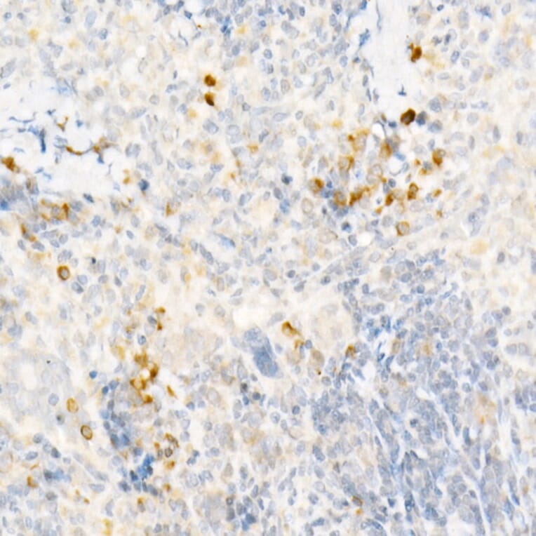 Immunohistochemistry - Anti-MCP1 Antibody (A12099) - Antibodies.com