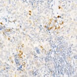 Immunohistochemistry - Anti-MCP1 Antibody (A12099) - Antibodies.com