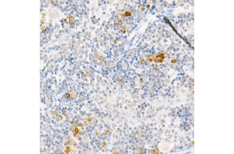 Immunohistochemistry - Anti-MCP1 Antibody (A12099) - Antibodies.com