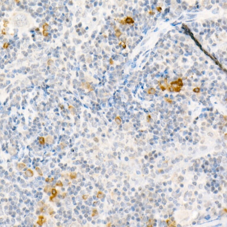 Immunohistochemistry - Anti-MCP1 Antibody (A12099) - Antibodies.com