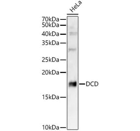 Western Blot - Anti-DCD Antibody (A12100) - Antibodies.com