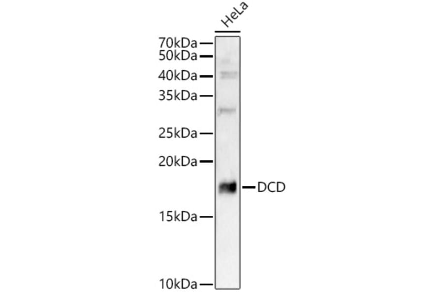 Western Blot - Anti-DCD Antibody (A12100) - Antibodies.com