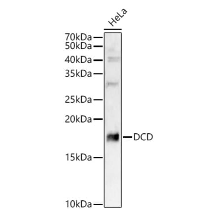 Western Blot - Anti-DCD Antibody (A12100) - Antibodies.com