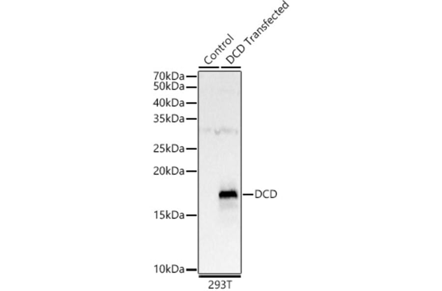 Western Blot - Anti-DCD Antibody (A12100) - Antibodies.com