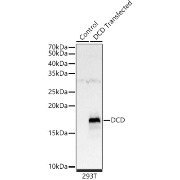 Western Blot - Anti-DCD Antibody (A12100) - Antibodies.com