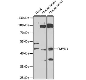 Western Blot - Anti-SMYD3 Antibody (A12102) - Antibodies.com