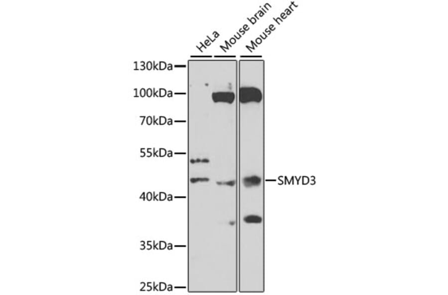 Western Blot - Anti-SMYD3 Antibody (A12102) - Antibodies.com