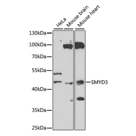 Western Blot - Anti-SMYD3 Antibody (A12102) - Antibodies.com