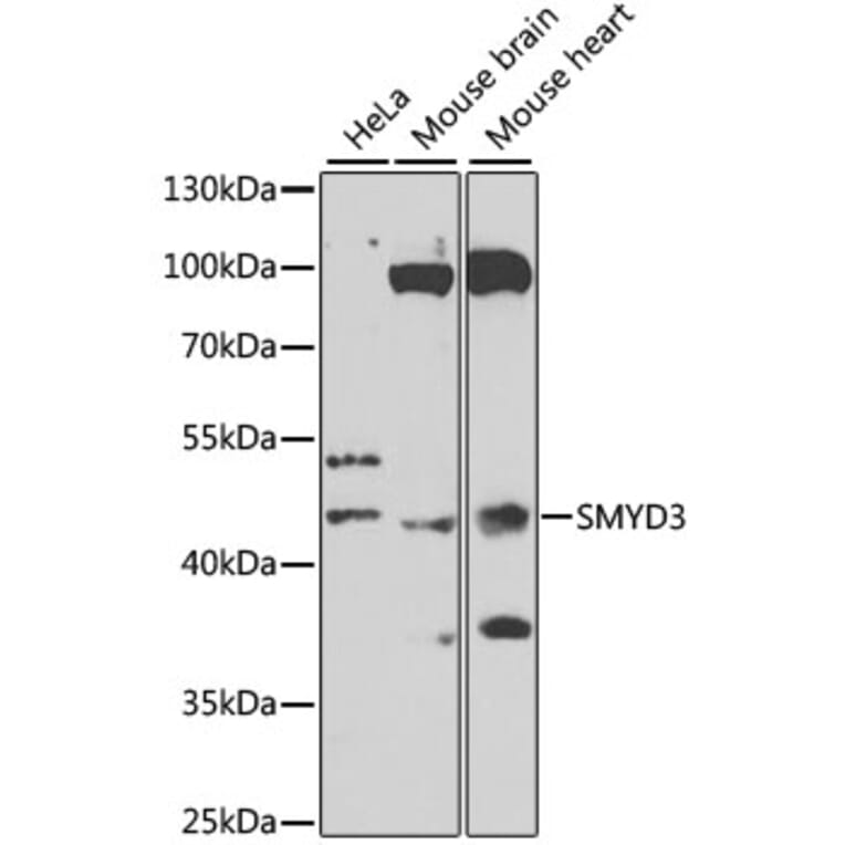 Western Blot - Anti-SMYD3 Antibody (A12102) - Antibodies.com