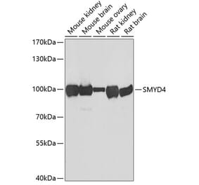 Western Blot - Anti-SMYD4 Antibody (A12103) - Antibodies.com