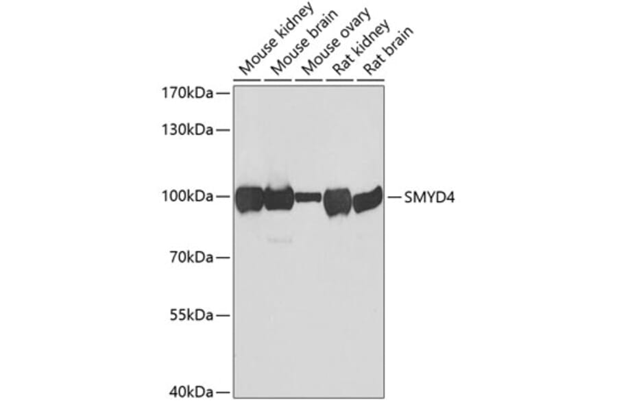 Western Blot - Anti-SMYD4 Antibody (A12103) - Antibodies.com