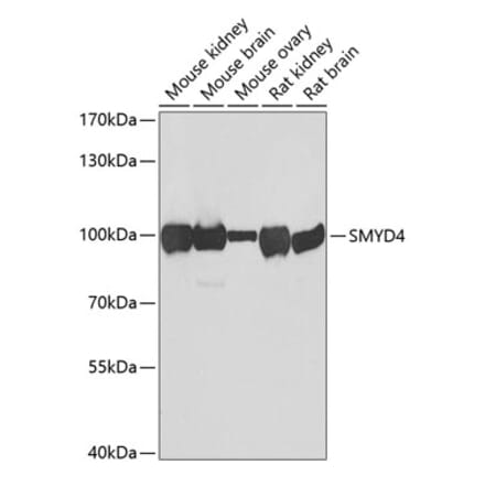 Western Blot - Anti-SMYD4 Antibody (A12103) - Antibodies.com