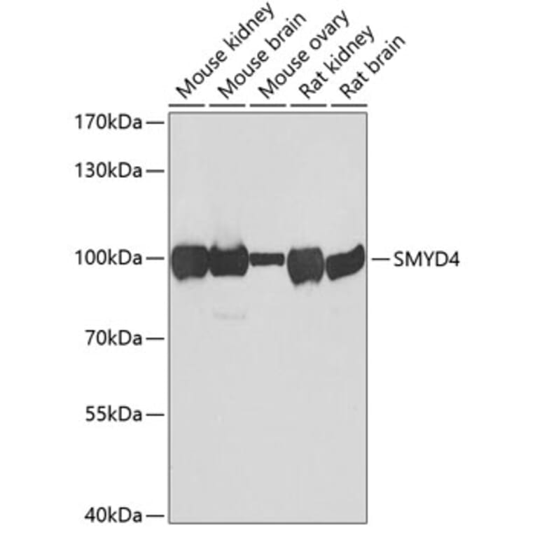 Western Blot - Anti-SMYD4 Antibody (A12103) - Antibodies.com