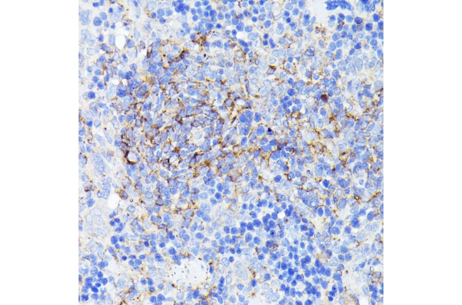 Immunohistochemistry - Anti-SMYD4 Antibody (A12103) - Antibodies.com