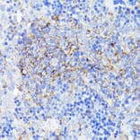Immunohistochemistry - Anti-SMYD4 Antibody (A12103) - Antibodies.com