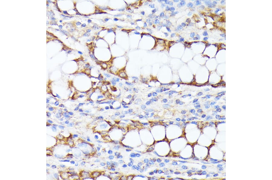 Immunohistochemistry - Anti-SMYD4 Antibody (A12103) - Antibodies.com