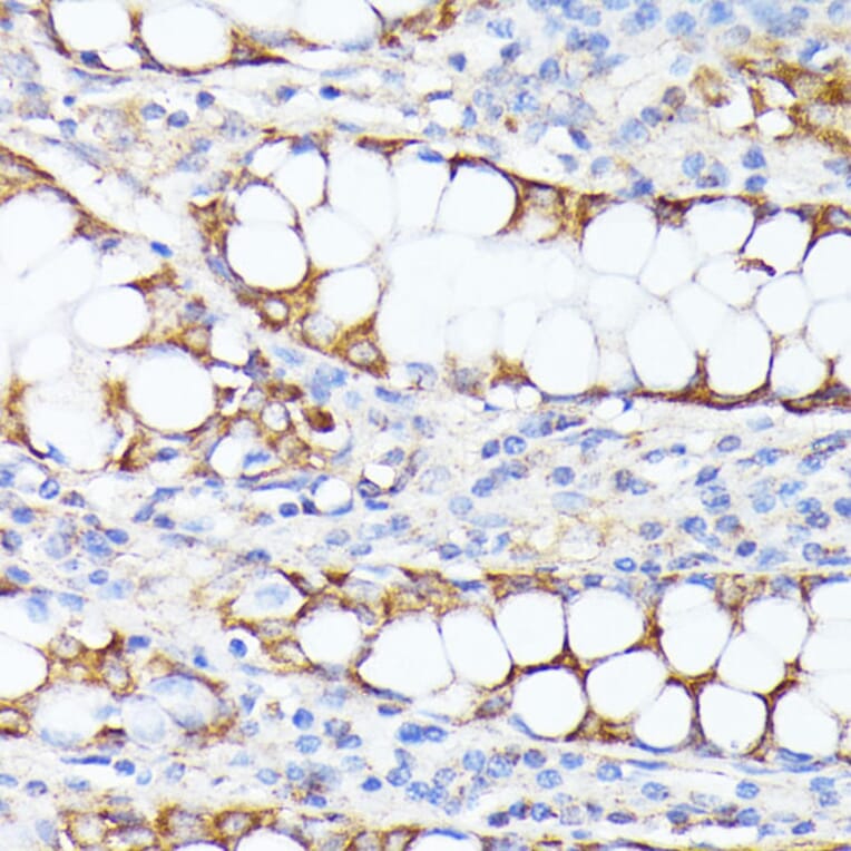 Immunohistochemistry - Anti-SMYD4 Antibody (A12103) - Antibodies.com