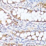 Immunohistochemistry - Anti-SMYD4 Antibody (A12103) - Antibodies.com