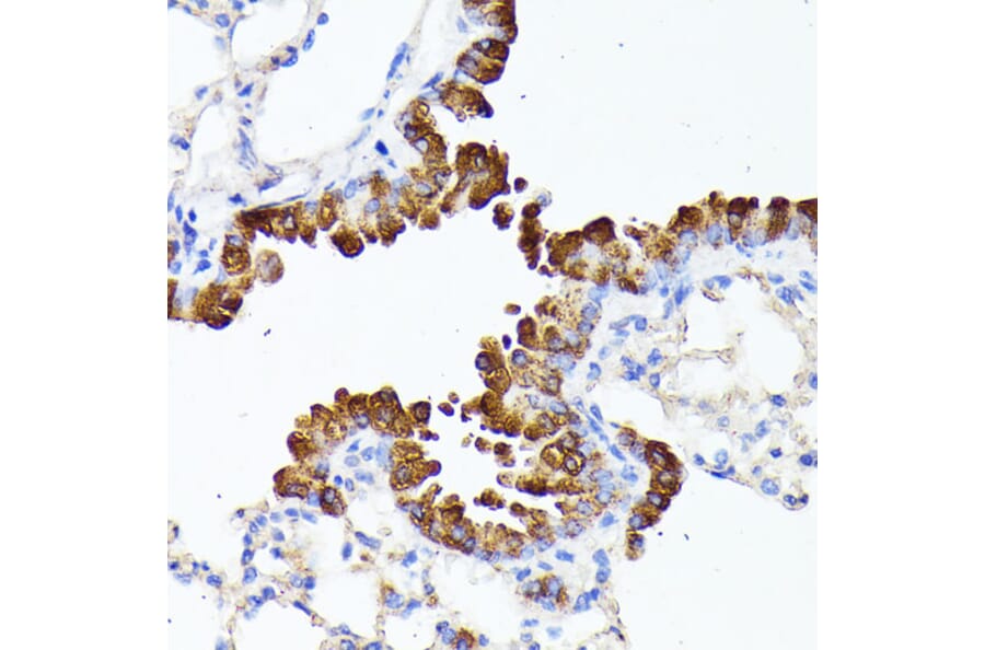 Immunohistochemistry - Anti-SMYD4 Antibody (A12103) - Antibodies.com