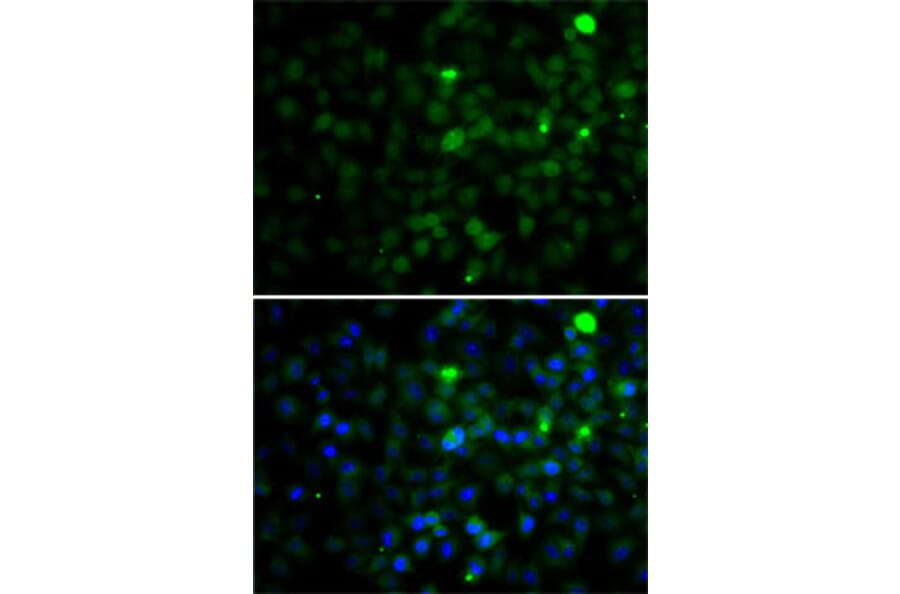 Immunofluorescence - Anti-SMYD4 Antibody (A12103) - Antibodies.com