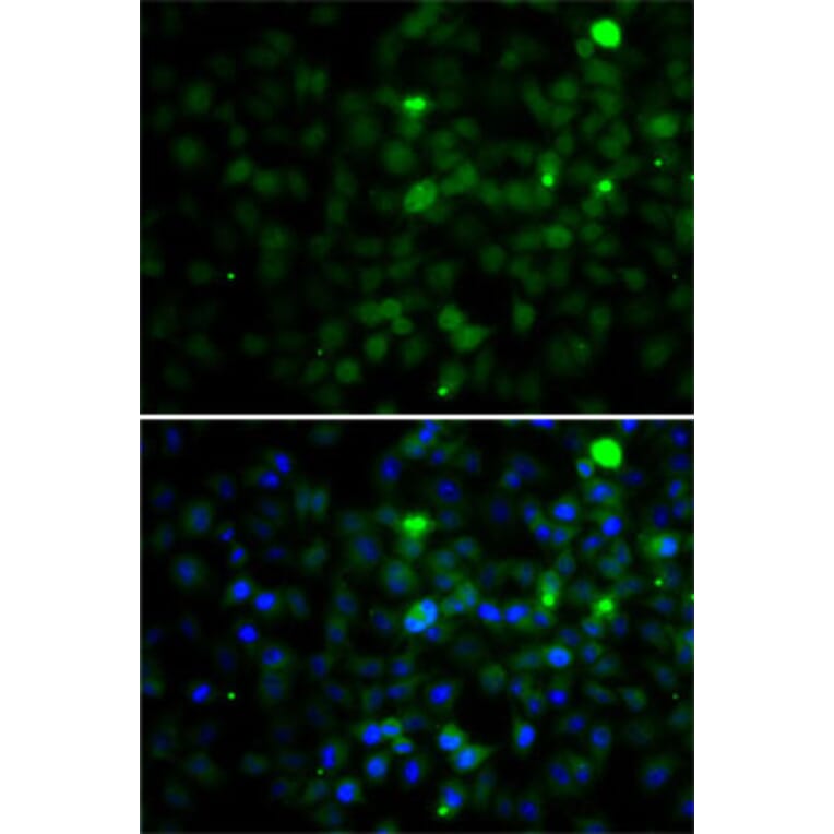 Immunofluorescence - Anti-SMYD4 Antibody (A12103) - Antibodies.com