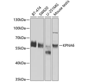 Western Blot - Anti-KPNA6 Antibody (A12105) - Antibodies.com