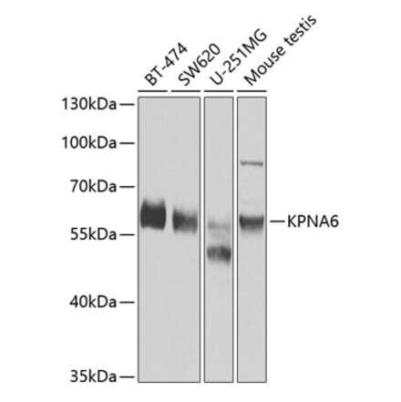 Western Blot - Anti-KPNA6 Antibody (A12105) - Antibodies.com