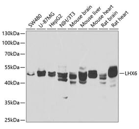 Western Blot - Anti-LHX6 Antibody (A12106) - Antibodies.com